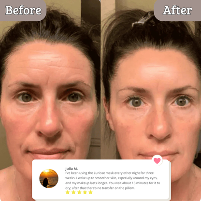 Lunisse™ — The Korean Beauty Secret